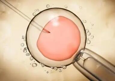 试管婴儿移植鲜胚如何查验是否着床成功，较早的8种怀孕症状介绍