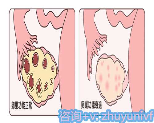 科学坐月子注意事项全面指南与代生服务推荐