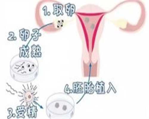 试管移植前后注意事项与助孕指南