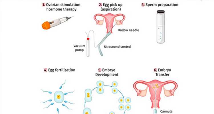 华西第二医院供卵试管费用解析：6万元预算是否足够？