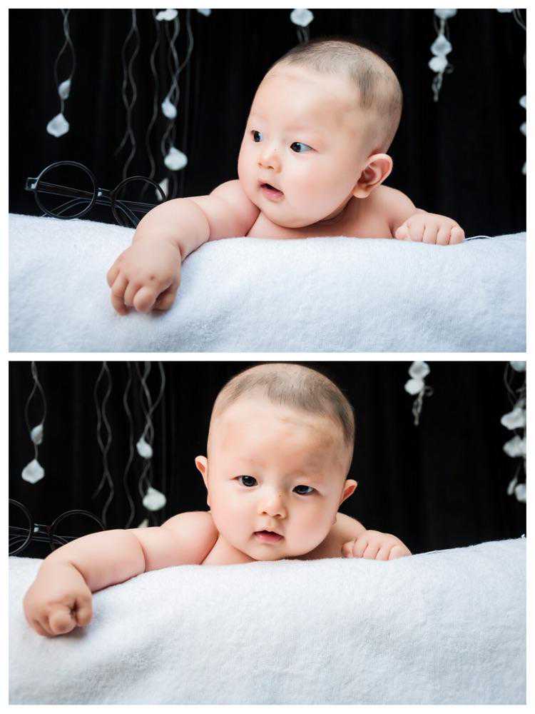 国内供卵医院与促排多胞胎减胎指南：安全助孕与代怀选择