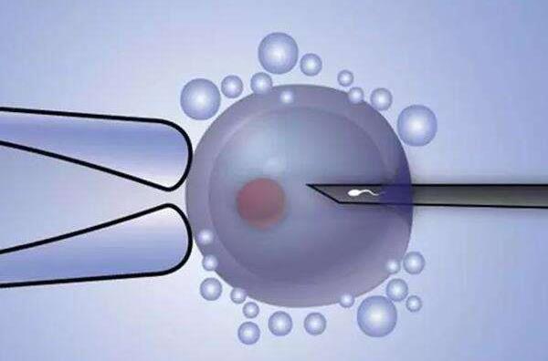 试管婴儿为什么都是两个胚胎提高成功率和降低风险